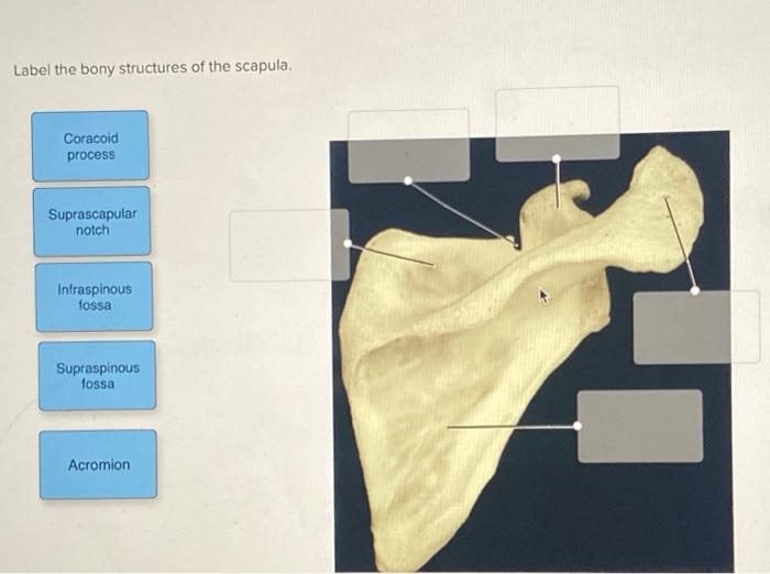 Solved Label the bony structures of the scapula. Coracoid | Chegg.com