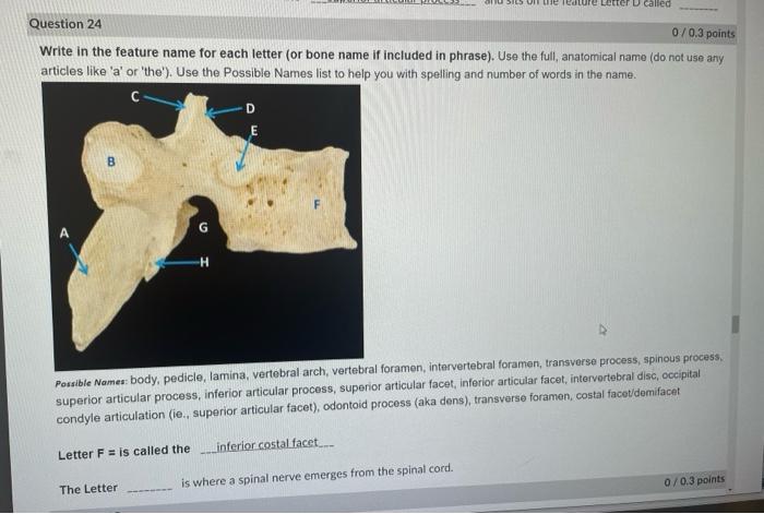 Solved Write in the feature name for each letter (or bone | Chegg.com