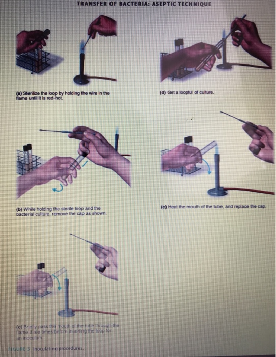 Solved 4. Transfer of Bacteria Aseptic Technique h. Were