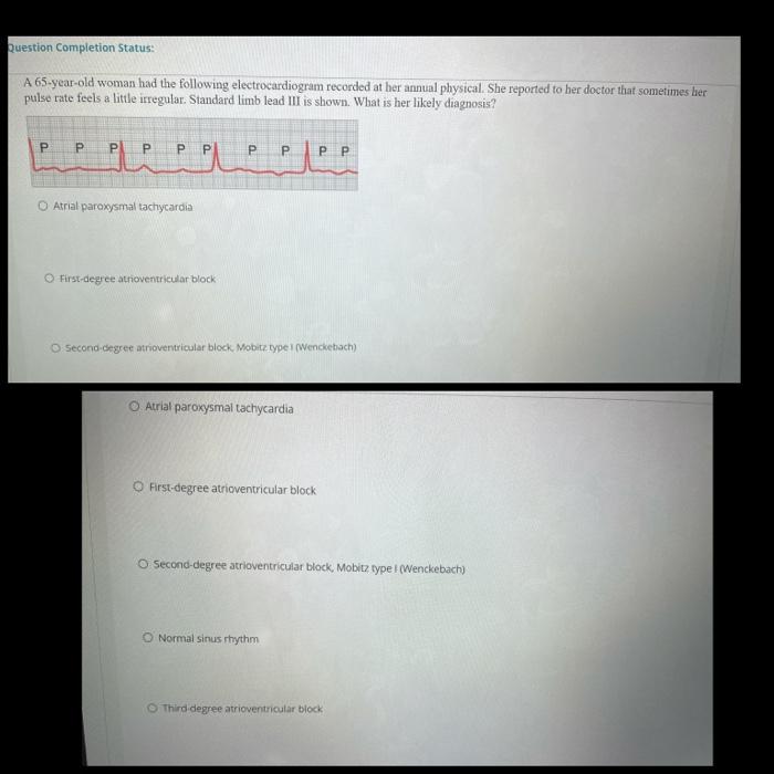 Solved Question Completion Status: A 65-year-old woman had | Chegg.com