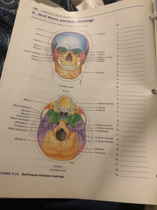 Solved A Cranial Bones And Bone Surface Markings Identif Chegg Com