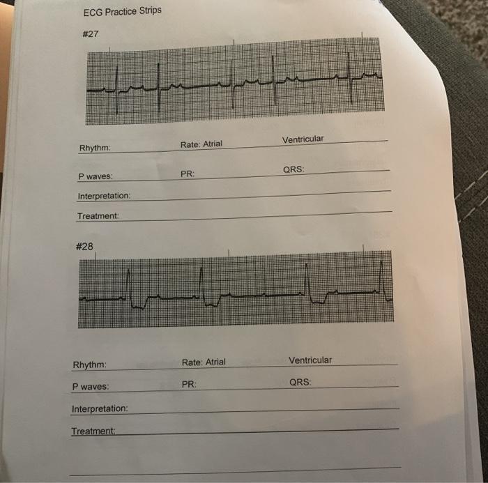 Solved ECG Practice Strips 27 Rhythm Rate Atrial