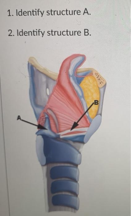 Solved 1. Identify Structure A. 2. Identify Structure B. B | Chegg.com