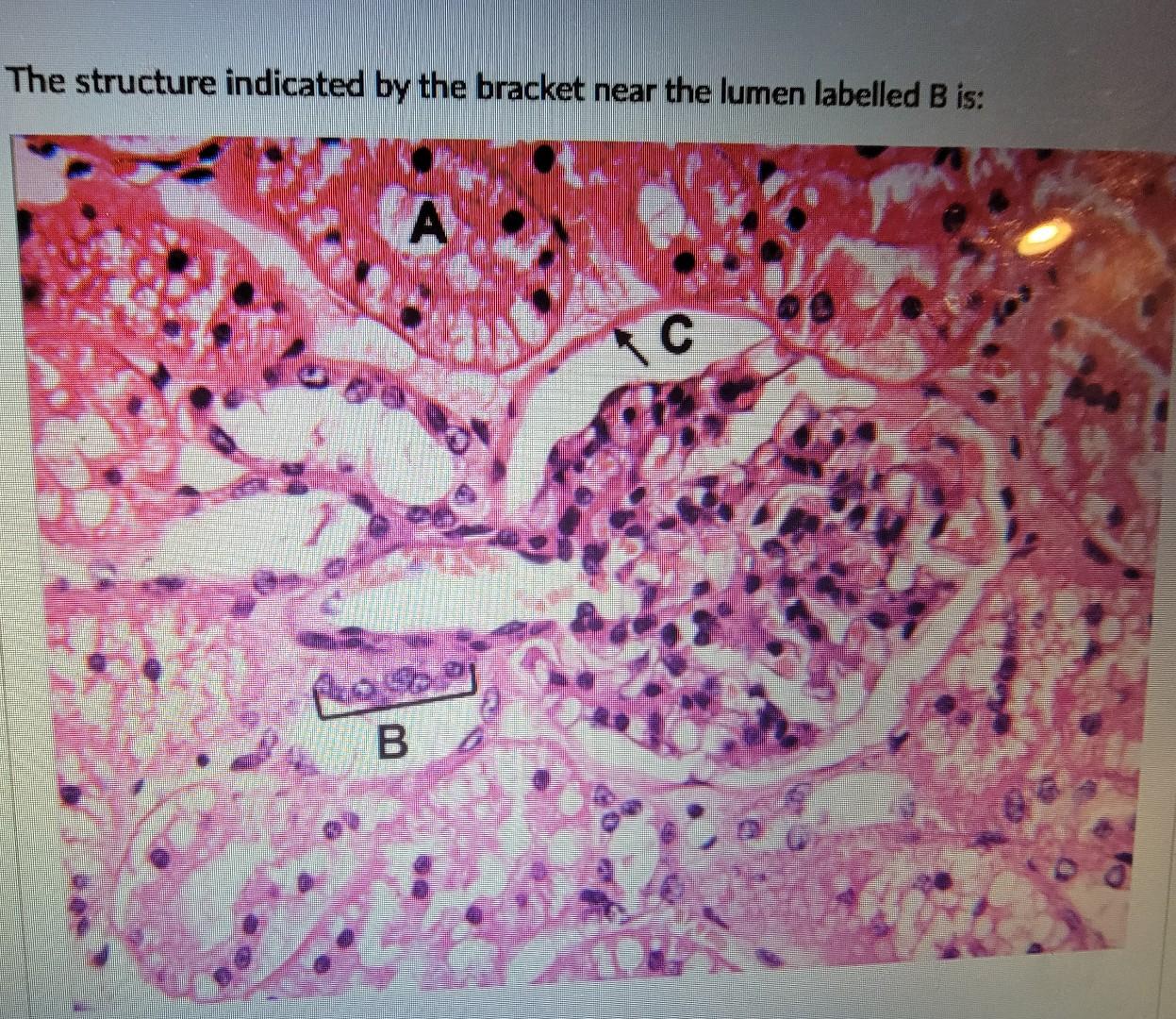 Solved Identify the structure indicated by C in the image | Chegg.com