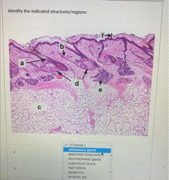 Solved Identify the indicated structures/regions: [Choose] | Chegg.com