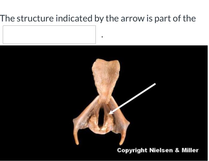Solved The structure indicated by the arrow is part of the | Chegg.com