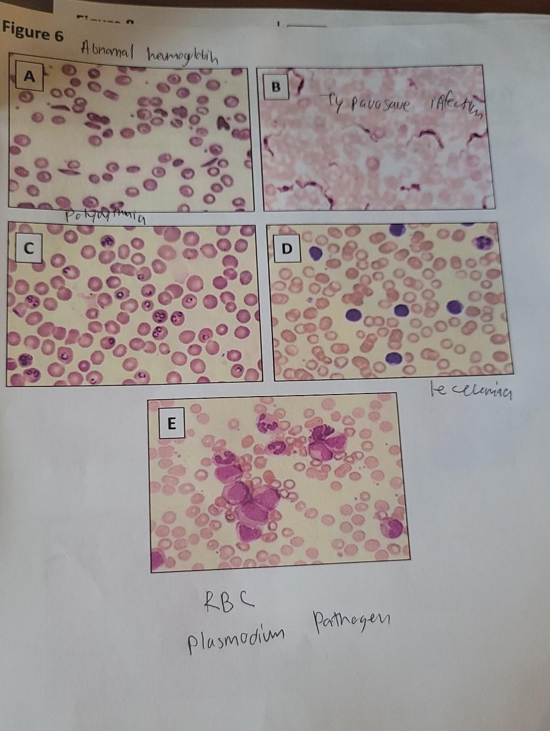 Solved Refer to Figure 6. Each of these panels shows a | Chegg.com