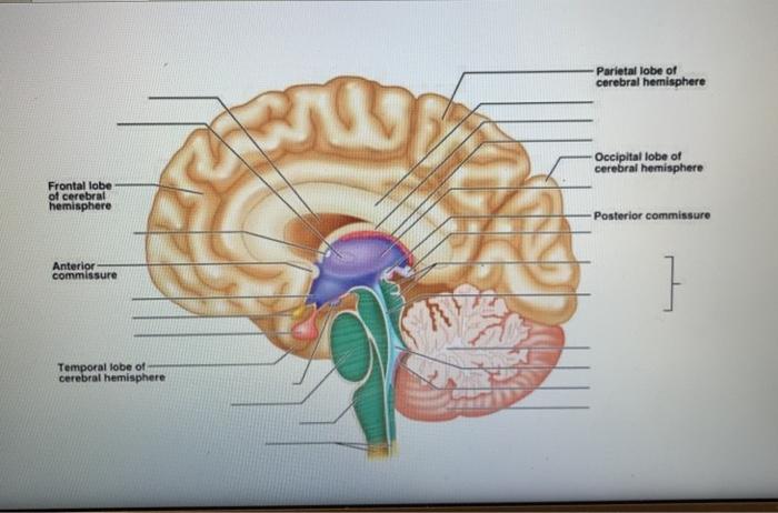 Solved Lab Report Frontal lobe Midbrain Temporal lobe | Chegg.com