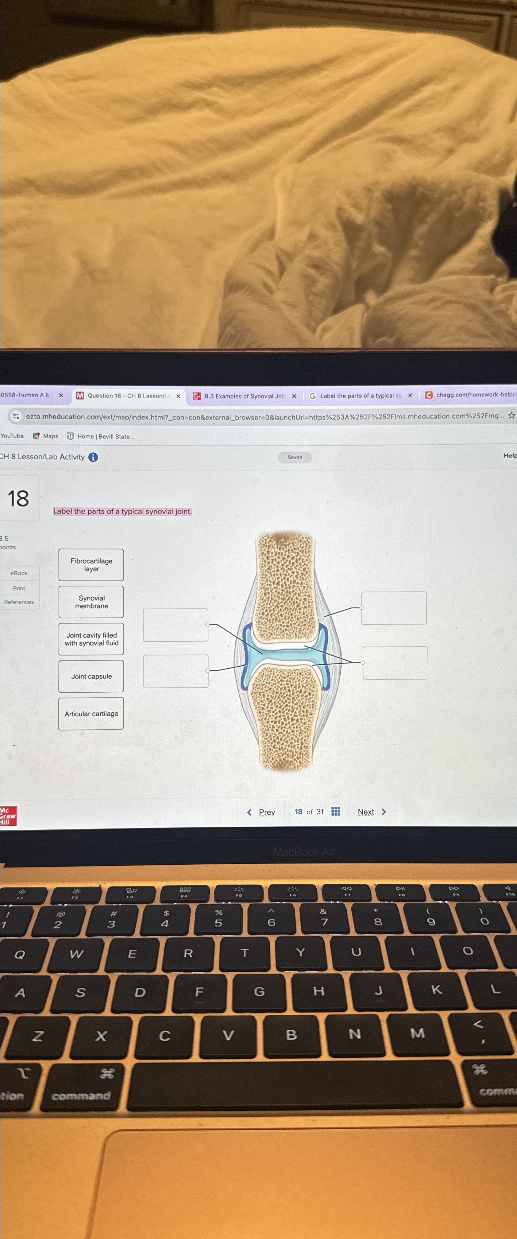 Solved Label the anterior view of the shoulder joint | Chegg.com