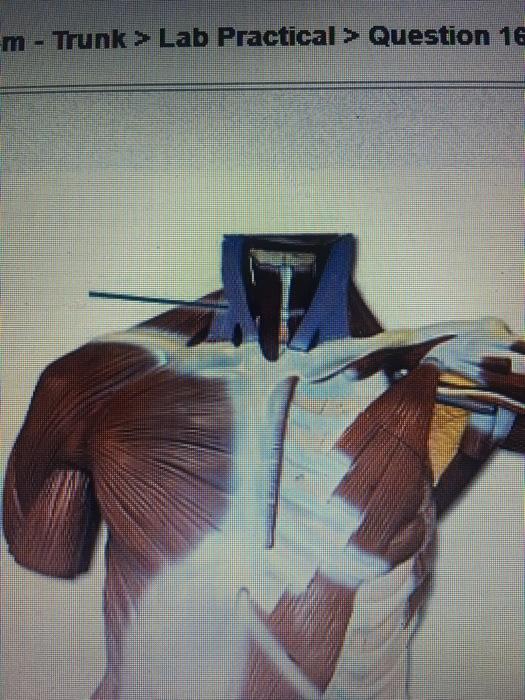 Solved 1) What action does rhe highlighted muscle have at | Chegg.com