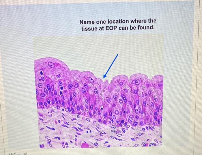 Solved Name one location where the tissue at EOP can be | Chegg.com