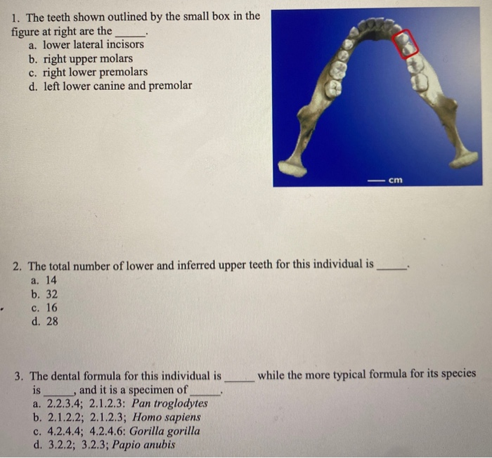 solved-1-the-teeth-shown-outlined-by-the-small-box-in-the-chegg