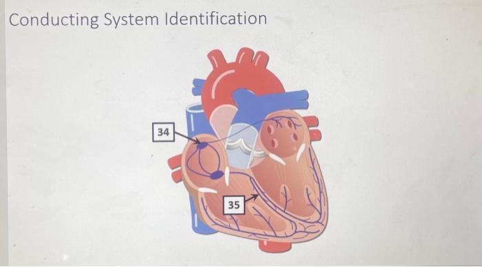 Heart Structure Identification - Interior These are | Chegg.com