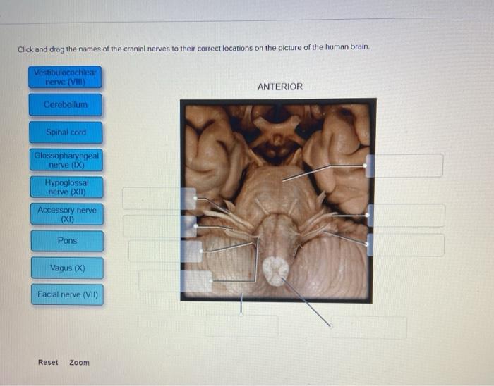 Click and drag the names of the cranial nerves to their correct locations on the picture of the human brain Vestibulocochlear