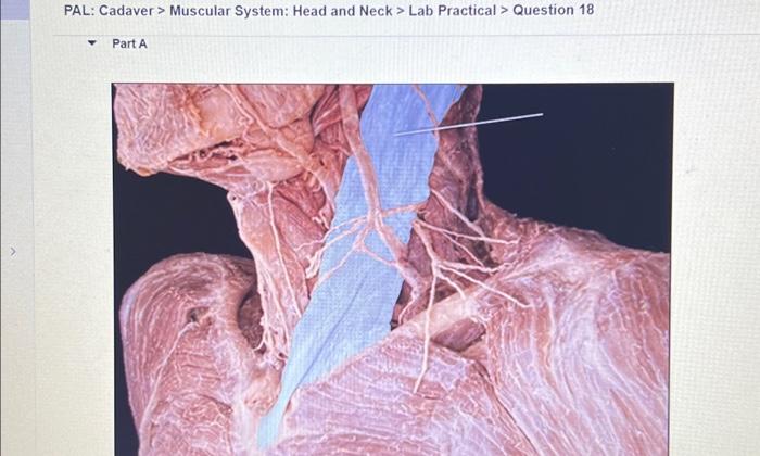 muscular system head and neck