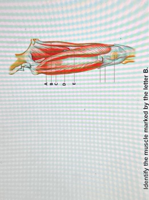 Solved Identify The Muscle Marked By The Letter B.The Muscle | Chegg.com