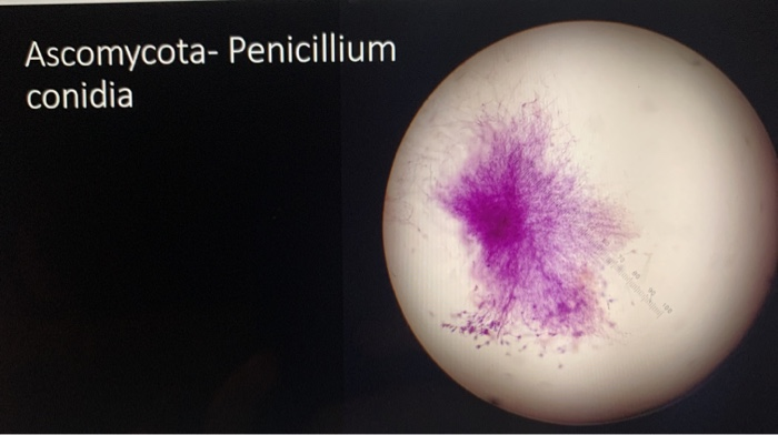 penicillium conidia slide
