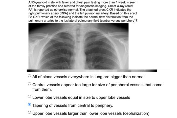 A 53-year-old male with fever and chest pain lasting more than 1 week is seen at the family practice and referred for diagnos