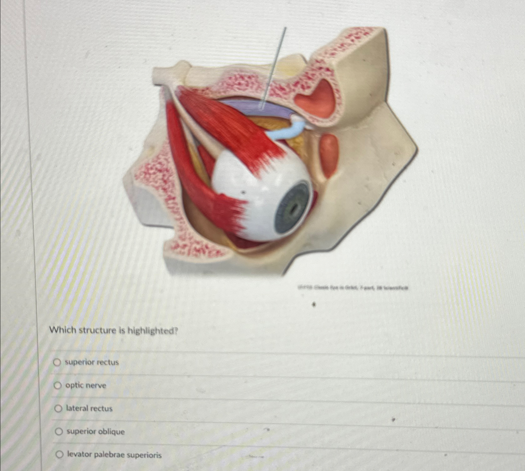 Solved Which structure is highlighted?superior rectusoptic | Chegg.com