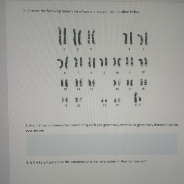 Solved 2. Observe the following human karyotype and answer | Chegg.com