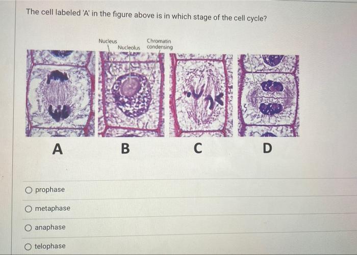 Solved The cell labeled 'A' in the figure above is in which | Chegg.com