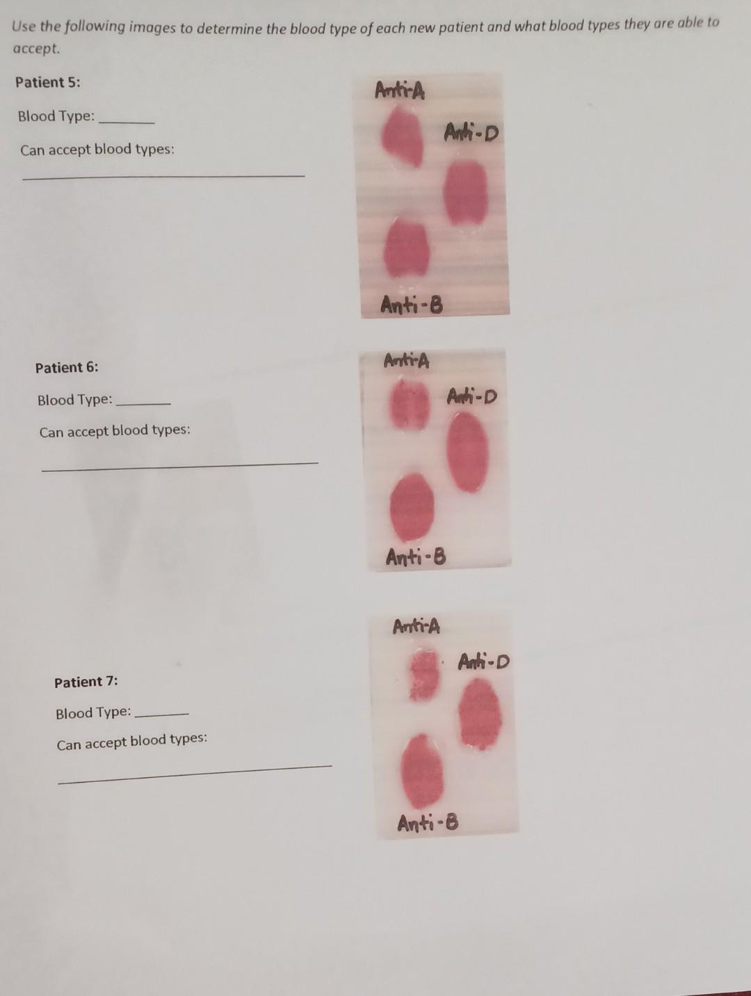 Solved Part 1: Blood Typing Be Sure To Have Read The 