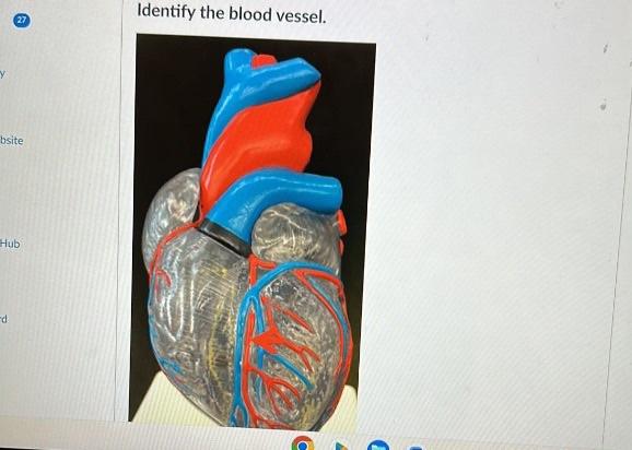 Identify the blood vessel.