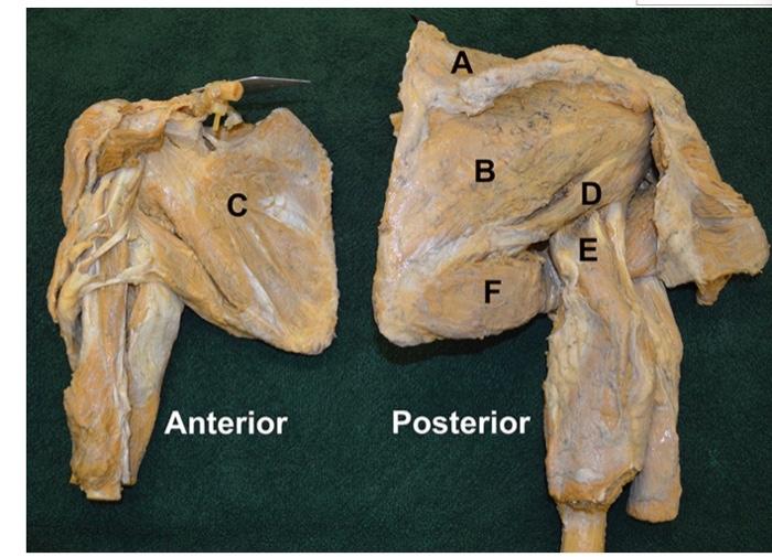 Solved rom the image of the rotator cuff above: dentify | Chegg.com