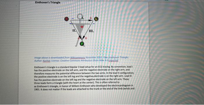 Solved Einthoven's Triangle irroge atove h downlooded from | Chegg.com