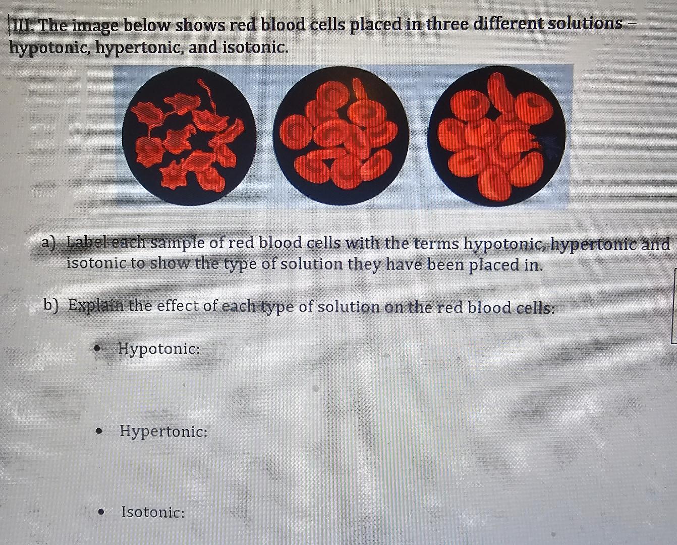 Solved III. The Image Below Shows Red Blood Cells Placed In | Chegg.com