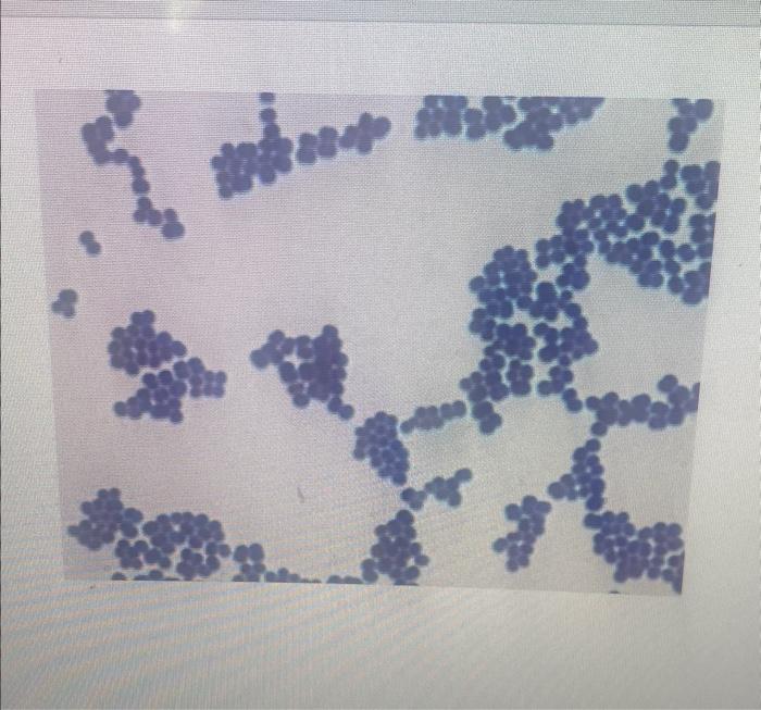 Solved Please for the microbiology lab practical how can I | Chegg.com