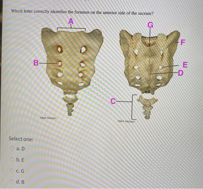 Solved Which letter correctly identifies the foramen on the | Chegg.com