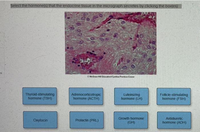 solved-select-the-hormone-s-that-the-endocrine-tissue-in-chegg