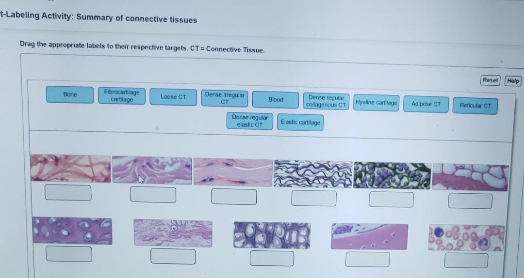 Solved tLabeling Activity Summary of connective tissues