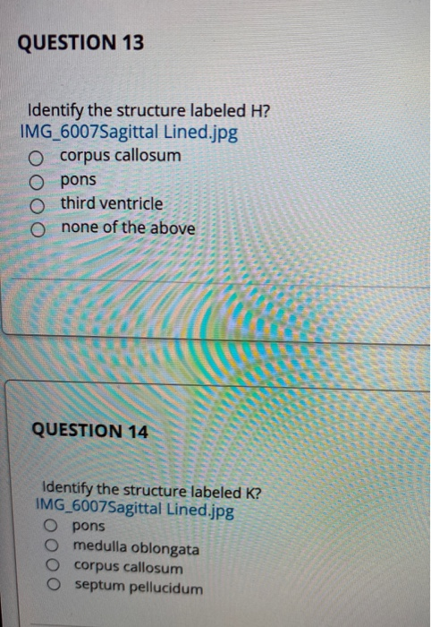 Solved B С D A E F к J H QUESTION 13 Identify the | Chegg.com