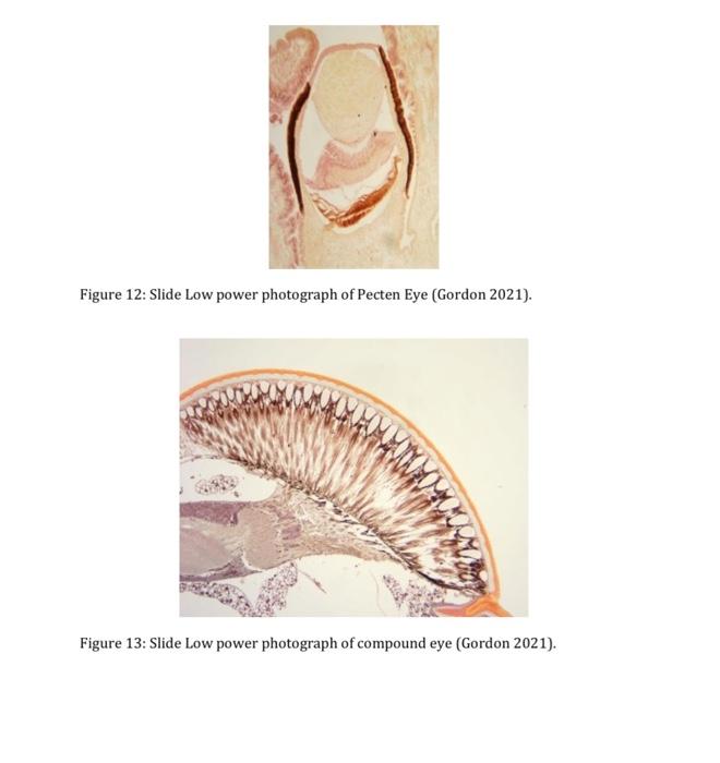 Figure 12 Slide Low power photograph of Pecten Eye