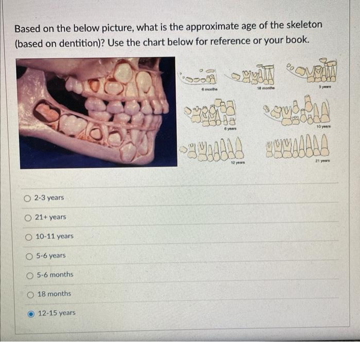 Based on the below picture, what is the approximate | Chegg.com