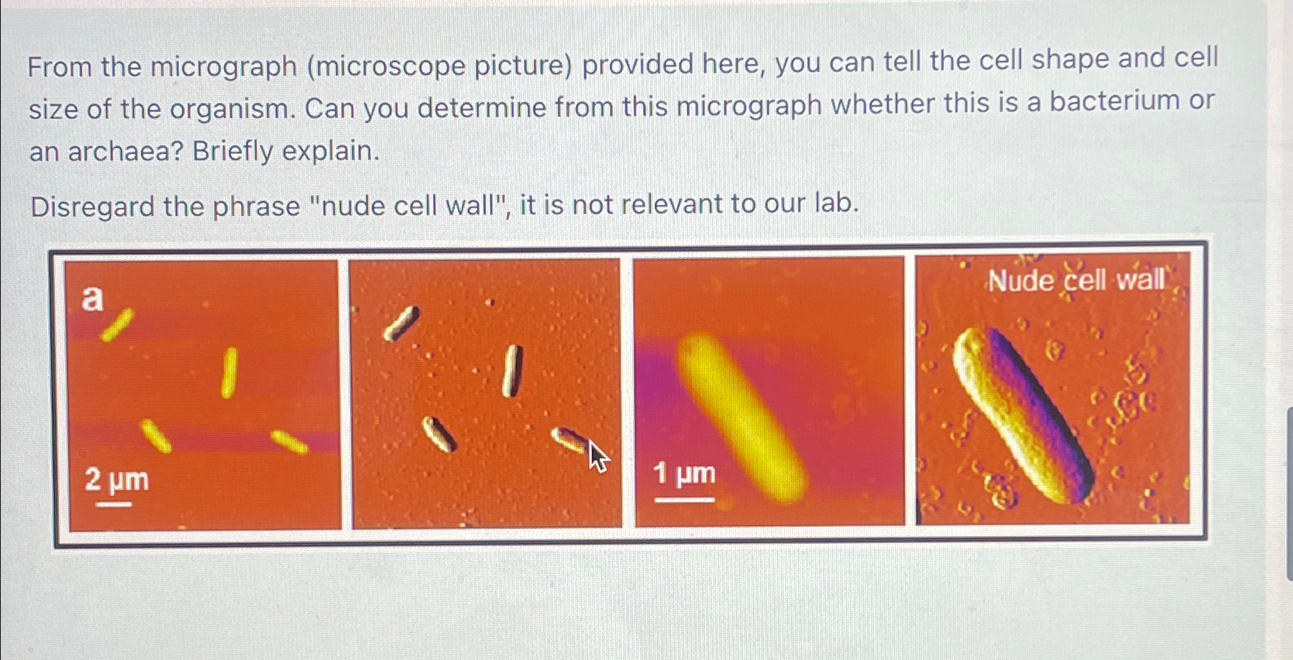 Solved From the micrograph (microscope picture) ﻿provided | Chegg.com