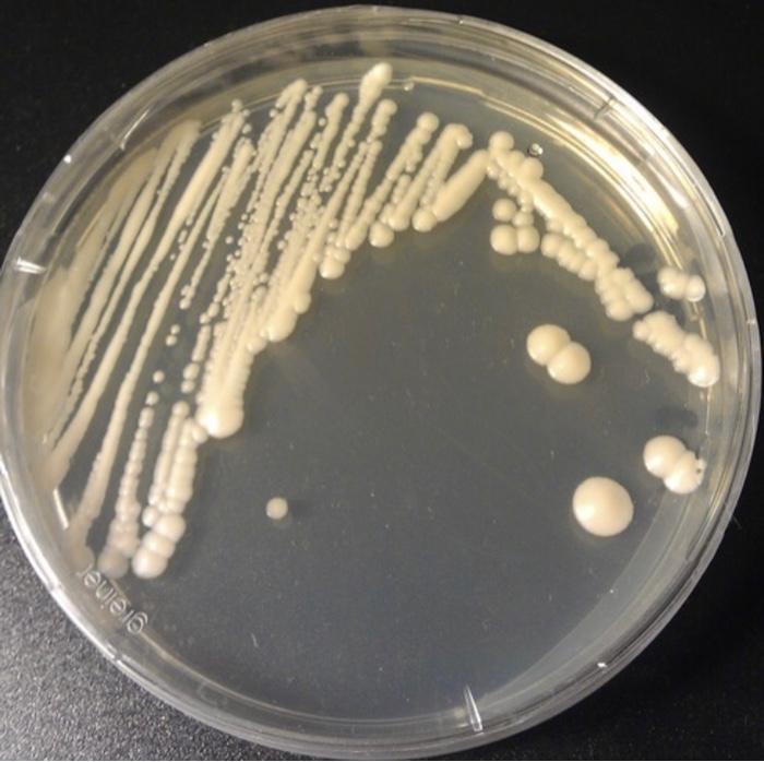 Solved Identify the colony shape:A) roundB) punctiform | Chegg.com