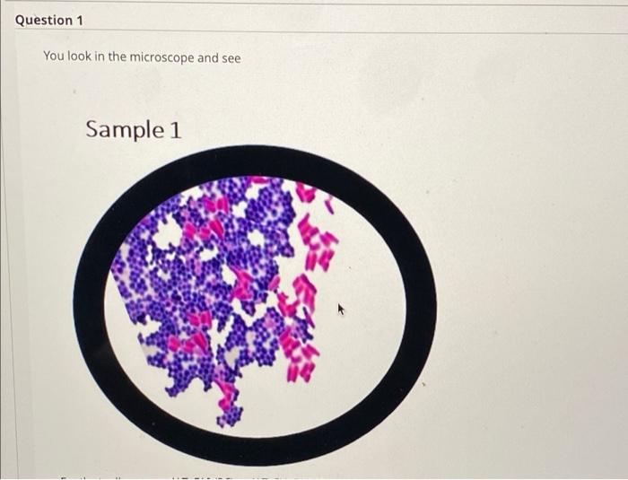Solved Question 1 You look in the microscope and see Sample | Chegg.com
