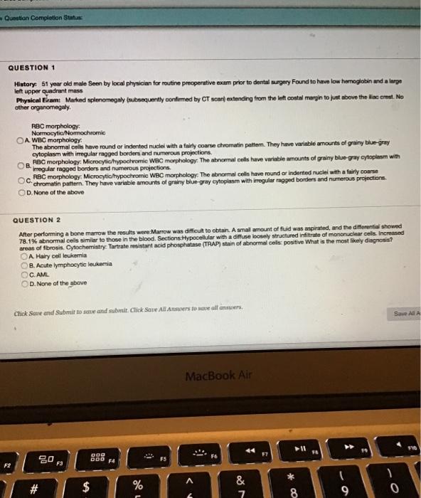 Question Completion Status QUESTION 1 History: 61 your old male Seen by local physician for routine preoperative exam prior t