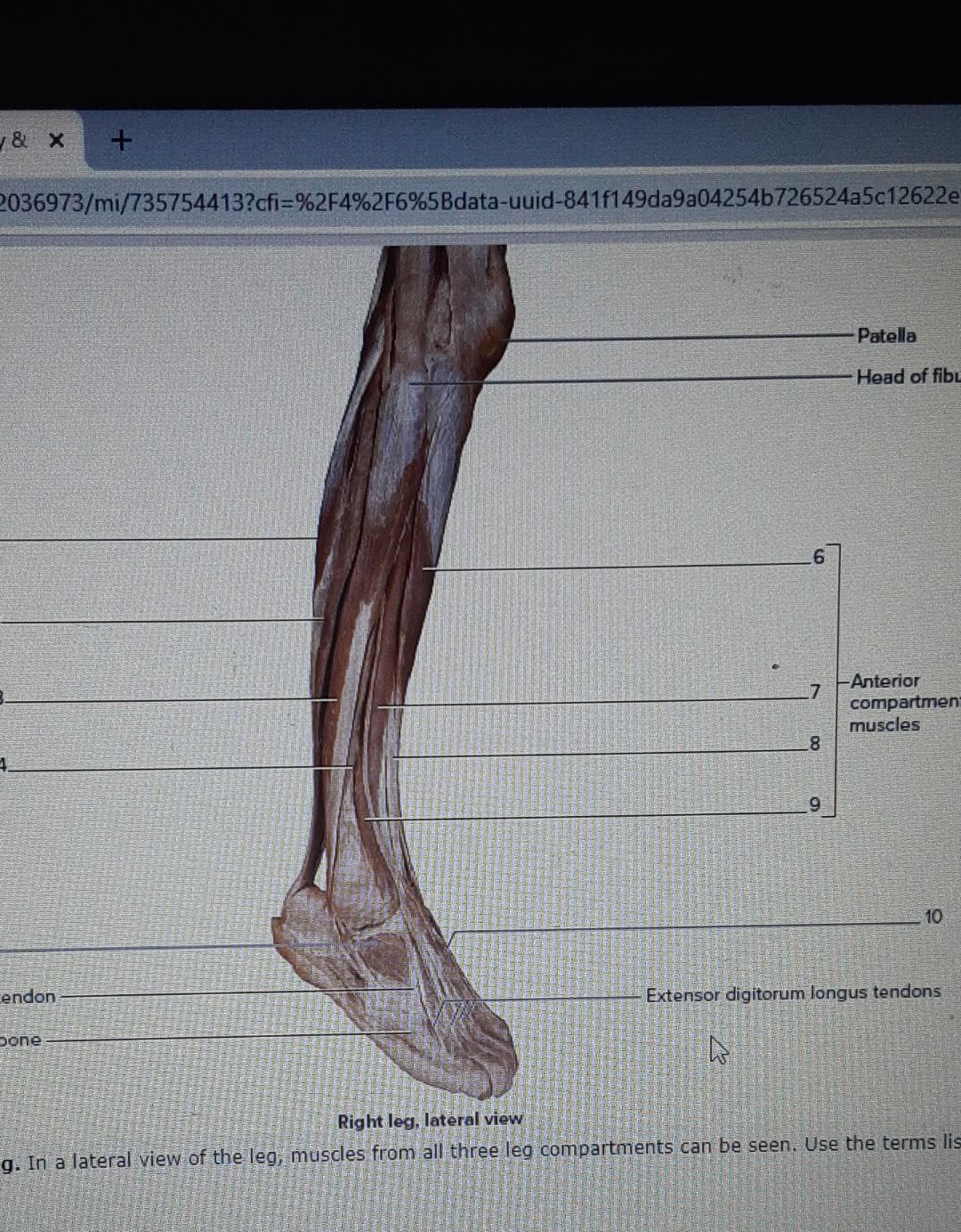 Solved 2. 3 4 5 6 Right leg, deep posterior view & X + | Chegg.com