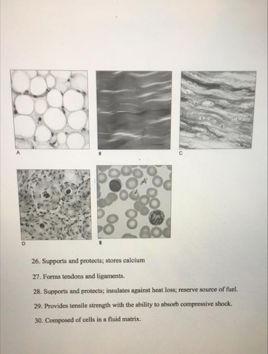 Solved D 26. Supports and protects; stores calcium 27. Forms