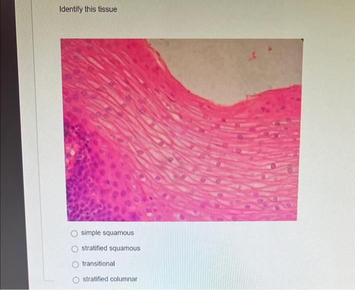 Solved Identify this tissue simple squamous stratified | Chegg.com