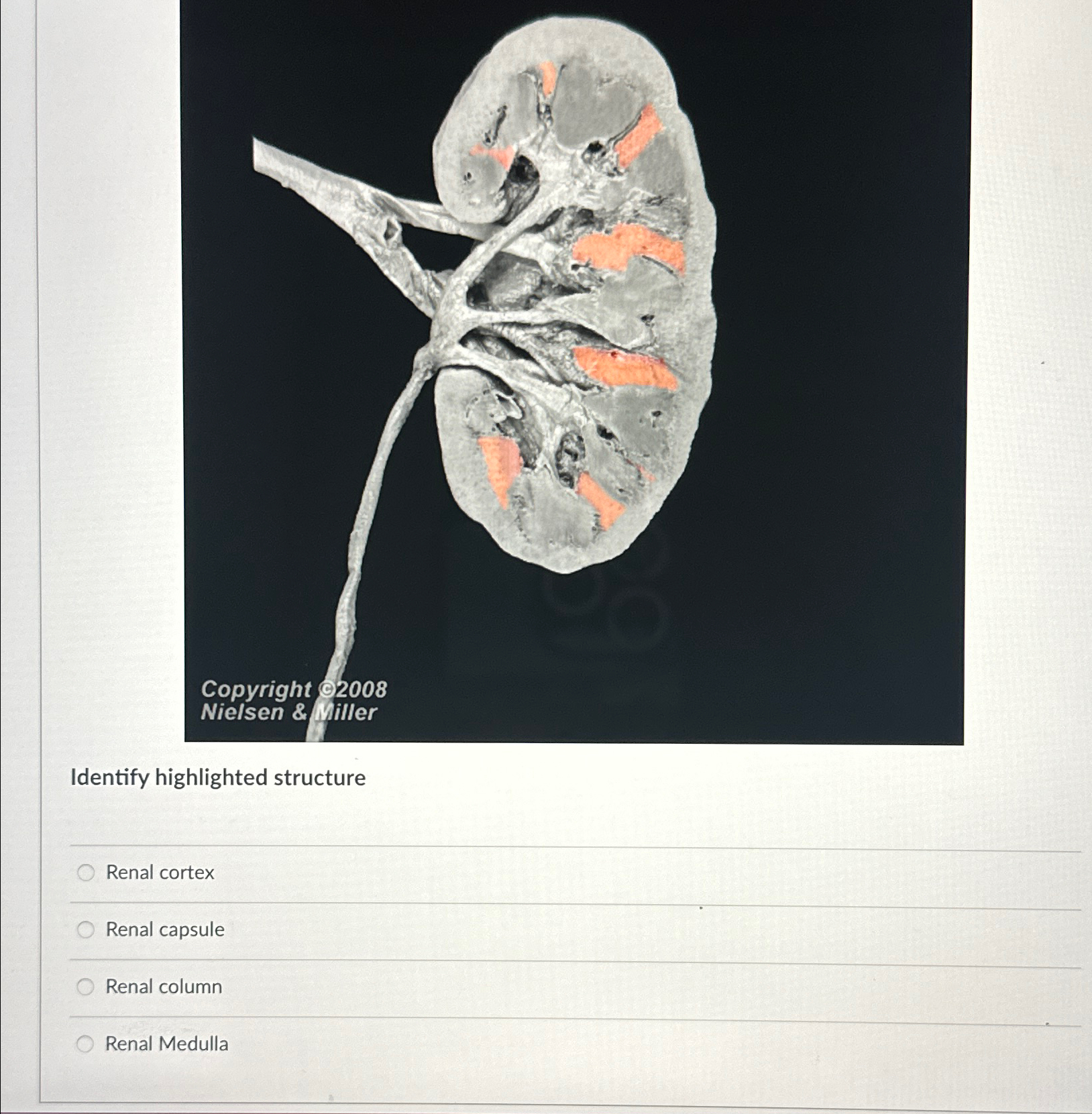 Identify The Highlighted Structure Urinary Systemfull Size Bronco Forum - 1kt1ud2
