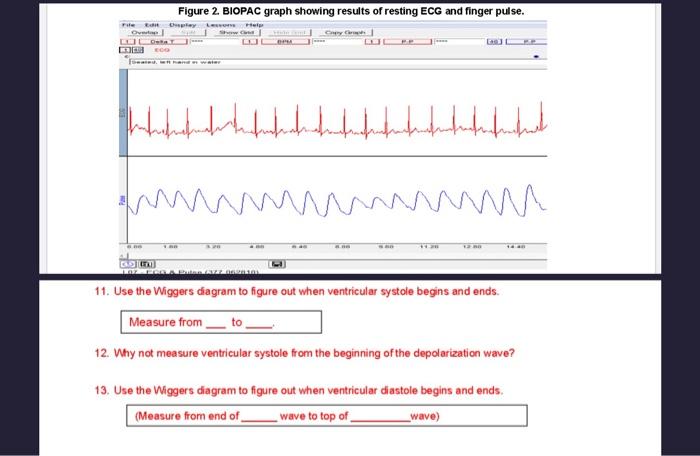 Solved Figure 2. BIOPAC graph showing results of resting ECG | Chegg.com