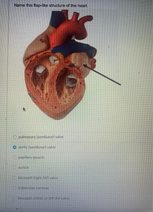 trabeculae carneae vs papillary muscle