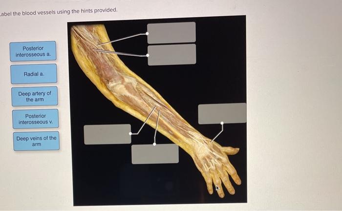 Solved Label the blood vessels using the hints provided. | Chegg.com