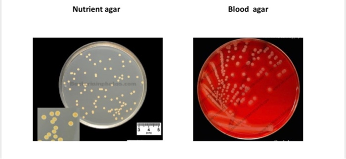 Solved Nutrient agar Blood agar inos.com PEA Mannitol salt | Chegg.com