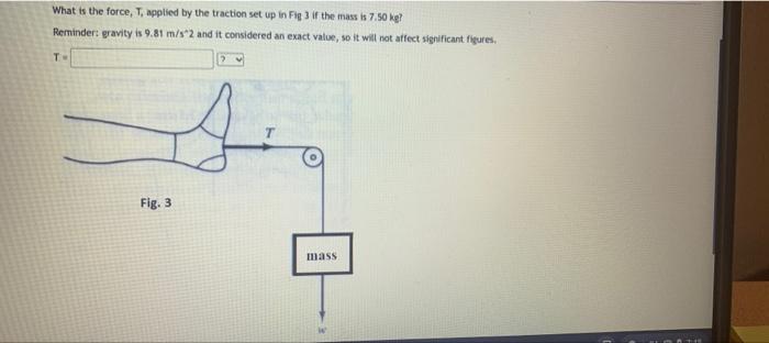 Solved What is the force, T, applied by the traction set up | Chegg.com